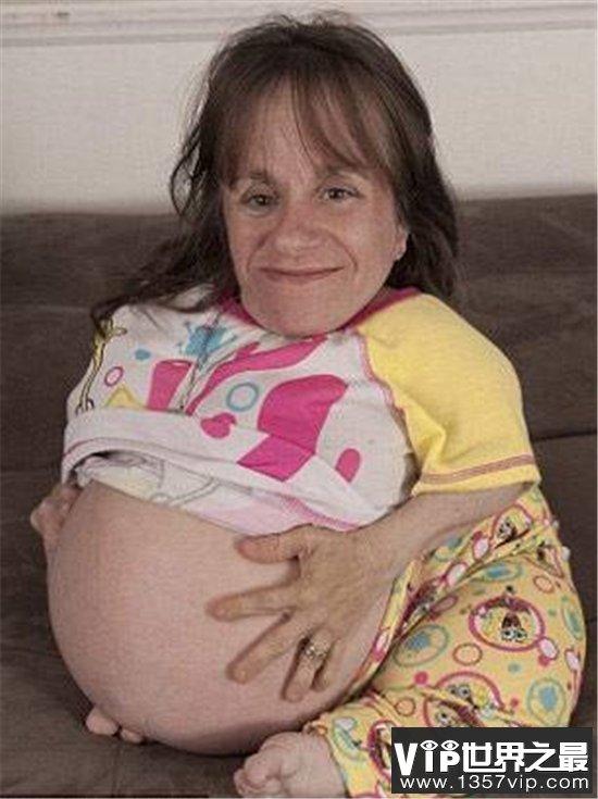 世界最小母亲斯泰西.赫拉尔德，天生患有脆骨病