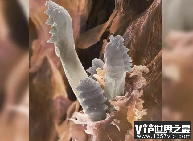 冬季是螨虫的复出期吗 冬季如何消除螨虫