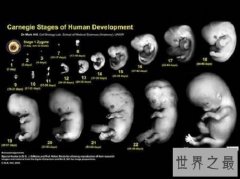 世界怀孕时间最长的人，怀孕了两年时间