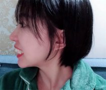 牙齿不整齐的女人 命运都会如何（女人牙齿）