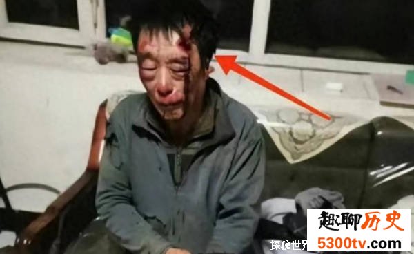 67岁老人讨薪被打 如何有效合理讨薪
