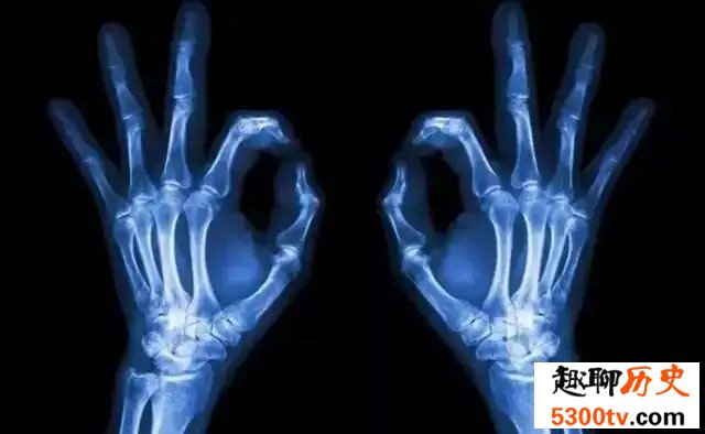 X射线为什么能拍出骨头的照片
