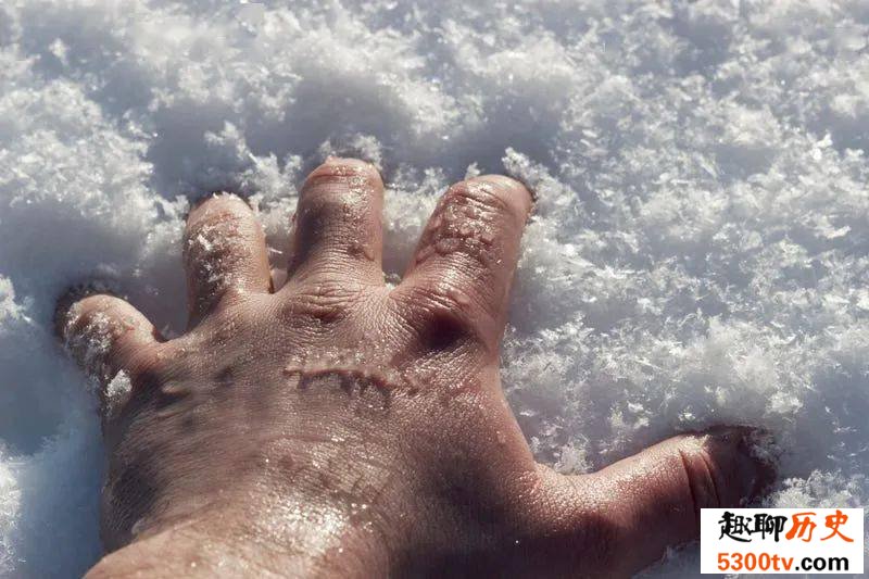 【辟谣】冻伤后用雪水搓洗能治好吗