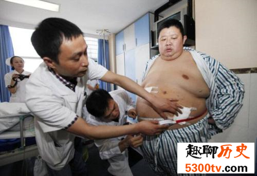 中国第一胖孙亮，体重高达600相当于4个成年人