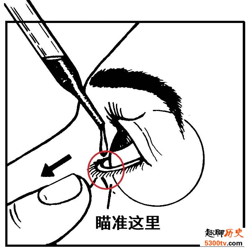 眼药水不要直接滴到眼球上 如何滴眼药水