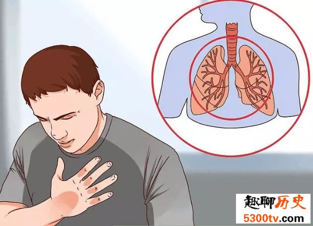 淋浴喷头也会潜藏细菌