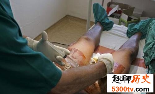 你知道割礼是什么意思吗 快来了解一下吧