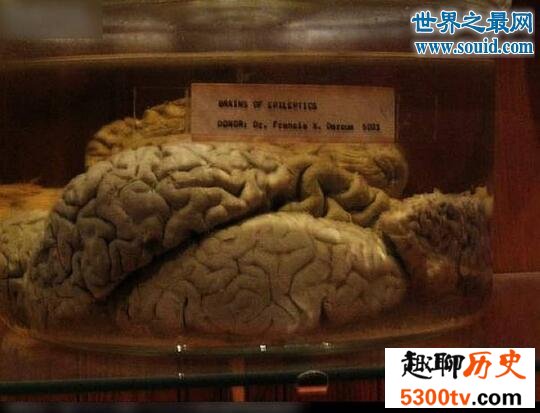 世界上最恐怖博物馆，美国费城马特博物馆(全是器官)