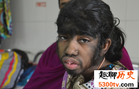 世界十大兽孩，被野兽养大的孩子。