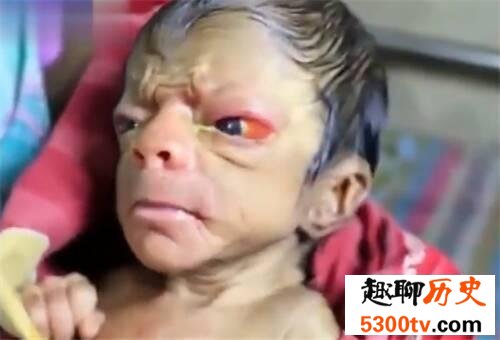 世界十大兽孩，被野兽养大的孩子。