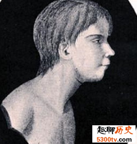 世界十大兽孩，他们的生活经历是多么的坎坷与无奈