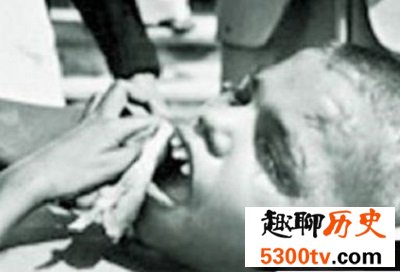 世界十大兽孩最详介绍，他们的童年经历你无法想象！