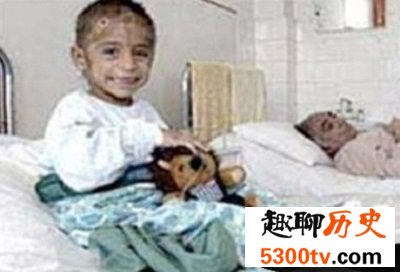 世界十大兽孩最详介绍，他们的童年经历你无法想象！